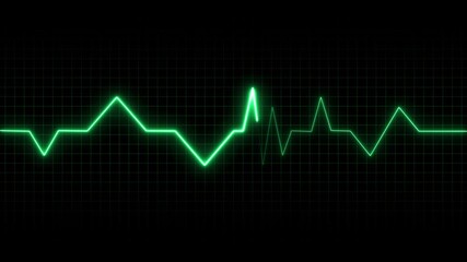 Green electrocardiogram line on a black grid background representing a heartbeat heart rate