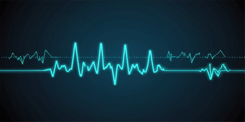 An electrocardiogram showing a pulsing green heartbeat rhythm on a hospital monitor