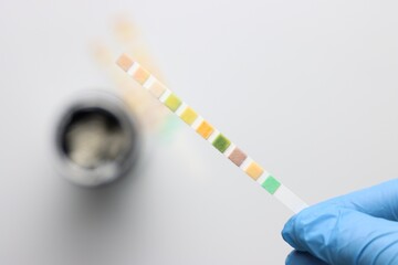 Urinalysis strips to test urine sample in a light background and copy space