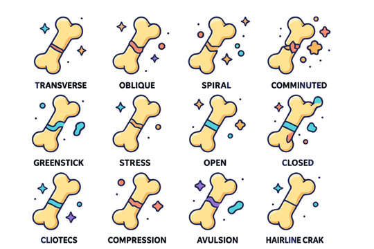 Bone Fracture Icons. Colorful isometric vector icons set of types of bone fractures: transverse fracture, oblique fracture, spiral