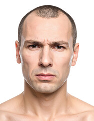 Obraz premium Closeup of a Bald Man with a Serious Expression.