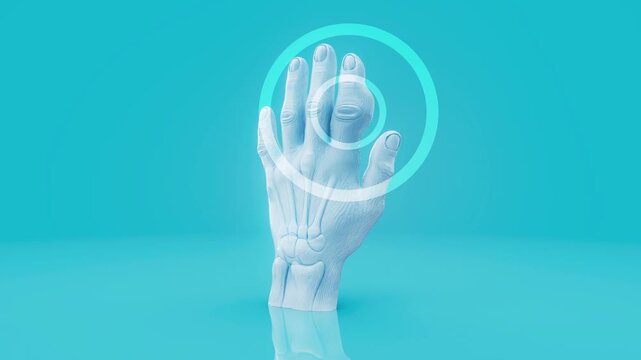 Conceptual 3D Animation of Gout in Finger Joint and Inflammation