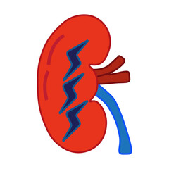 Obraz premium Acute Kidney Injury