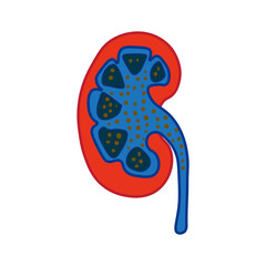 Nephrotic Syndrome