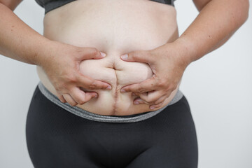 A close-up image of an overweight Asian woman pinching belly fat against a white background. The photo highlights body weight issues, insecurity, and health concerns related to central obesity.