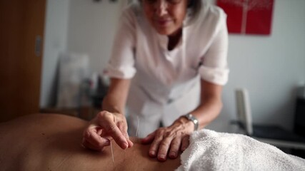 Professional acupuncturist inserting sterile needles into a patient's back during a traditional chinese medicine therapy session for pain relief, healing and overall wellness in a clinic
