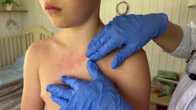 The boy has a rash that could be related to an allergy or infection.