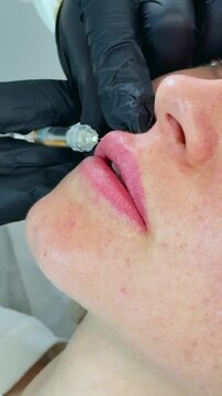 Macro vertical filler injection upper lip volume enhancement mature woman thin lips cosmetic doctor black gloves hyaluronic acid procedure skin detail beauty