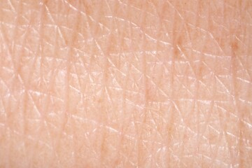 Human skin, closeup view. Detailed texture of surface