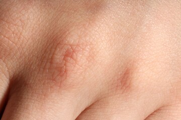 Fototapeta premium Macro view of normal skin as background