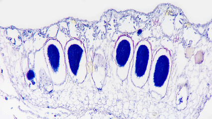 Longitudinal section of Marchantia sp. antheridial head (antheridiophore) showing antheridium (dark blue)