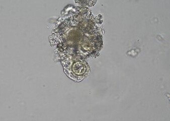 soil microorganisms under a microscope including amoeba, flagellates, nematodes, fungi, bacteria	