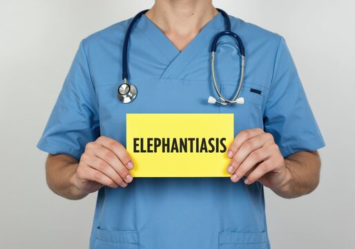 Medical Professional Holding Elephantiasis Sign: A dedicated medical professional, clad in clinical attire, holds a sign with the word Elephantiasis.