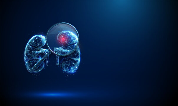 Kidney under magnifying glass with red spot inside Inflammation, infection, kidney disease, medical diagnosis, nephrology research, health monitoring concept.