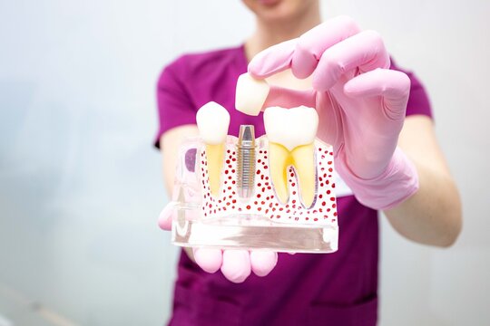 close-up of dentist hand with dental tools woman