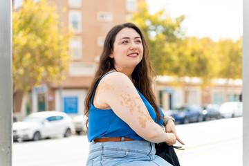 Woman with vitiligo embracing body positivity outdoors