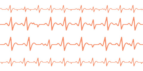 Green EKG line graph showing a heartbeat rhythm on a medical monitor trace for **