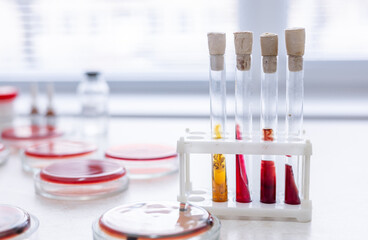 Microbiology hand medical working on agar plate culture bacteria and drug resistance of pathogens in laboratory and bacterial identification