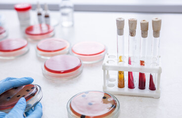 Microbiology hand medical working on agar plate culture bacteria and drug resistance of pathogens...