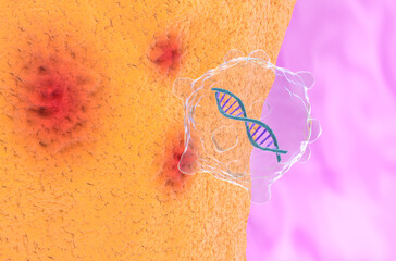 Gene therapy in Rheumatoid arthritis - closeup view 3d illustration