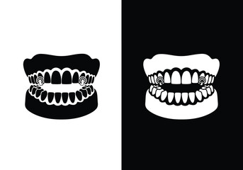 Black and white silhouette icons of human jaws with teeth and two dental implants.