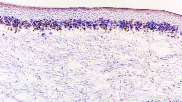 Section of lichen under the microscope. The upper dark-purple layer represent the algal component (photobiont), while the lower layer represents the fungal mycelium (mycobiont)