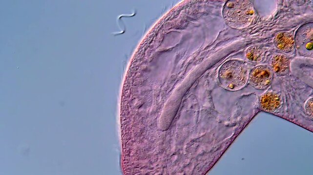 Blepharisma ciliate microorganism, microscope 400x magnification 