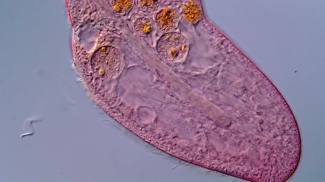Blepharisma cilia High Resolution under microscope 