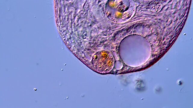Ciliophora microorganism under microscope view 400x magnification 