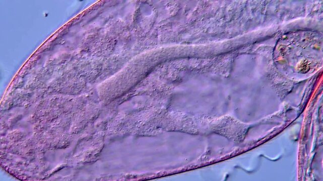 Blepharisma protozoa detail under microscopy view High Resolution 