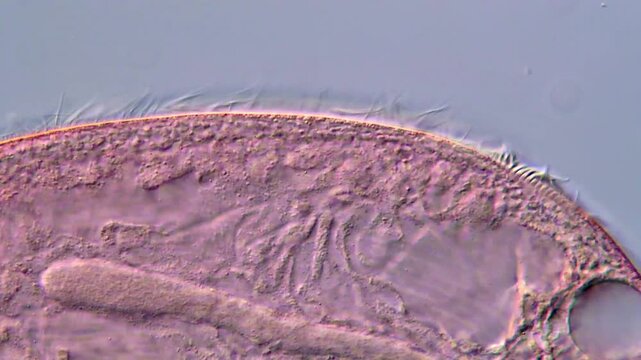 Blepharisma ciliate protozoa under microscopy view 