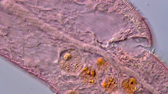 Blepharisma ciliate protists under microscope view 