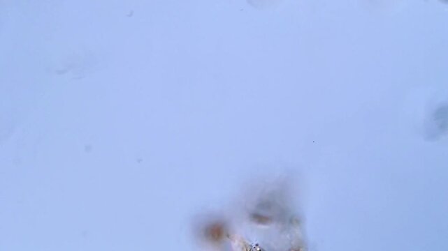 Blepharisma protozoa under microscope, 400x magnification 