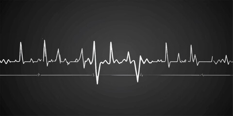 Green electrocardiogram line showing a healthy heartbeat on a medical monitor