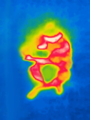 A man who has absorbed a lot of information and is bloated. Image from thermal imager device.