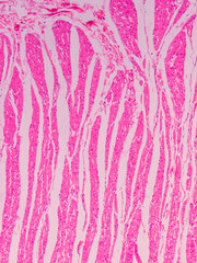 Ileum Histology with Villi and Crypt