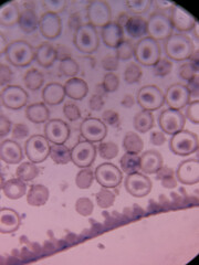 Microscopic View of Ascaris Cleavage Stage