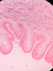 Histology of Normal Bladder Wall under the microscop