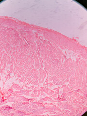 Histology of Normal Bladder Wall under the microscop