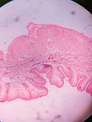 Histology of Normal Bladder Wall under the microscop