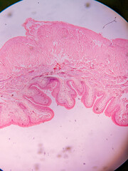 Histology of Normal Bladder Wall under the microscop
