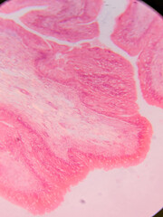 Histology of Normal Bladder Wall under the microscop