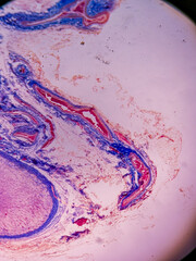 Adrenal Gland with Cortex and Medulla