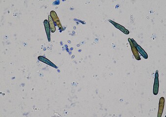 soil microorganisms under a microscope including amoeba, flagellates, nematodes, fungi, bacteria	
