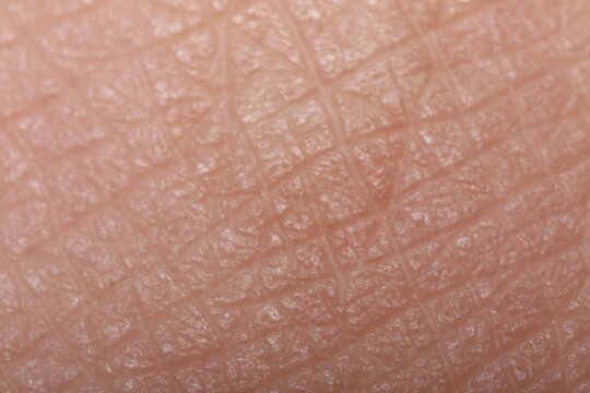 Macro view of dry human skin with wrinkles as background