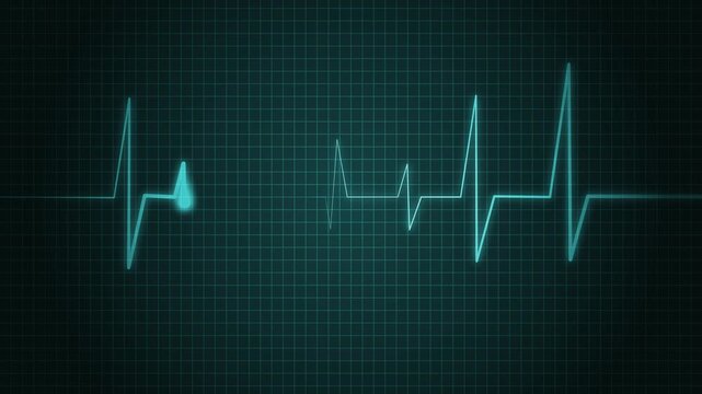Heartbeat Line Wave Signal Animation with Continuous Pulse and Medical Monitoring