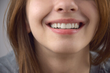 The transparent mouth guards for teeth at night after wearing braces.