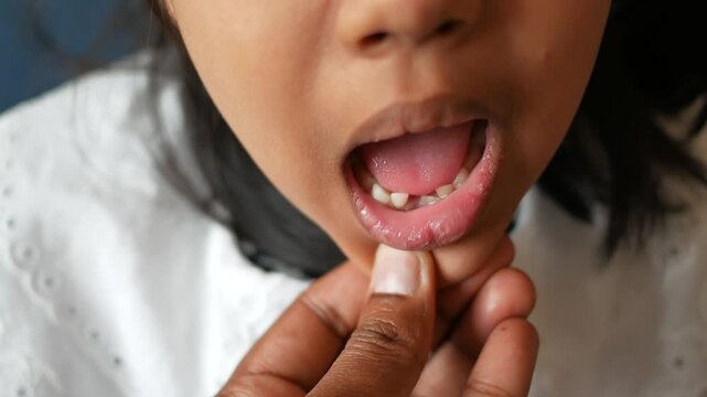 Child with missing teeth 4k video