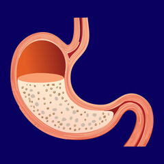 The Human Stomach Fully Breaking Down Food into Fine Chyme Consistency Ready for Efficient Nutrient Absorption  © firstcolor