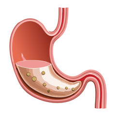 Human Stomach Anatomy Illustrating the Early Stages of Food Digestion with Gastric Juices and Initial Breakdown	
